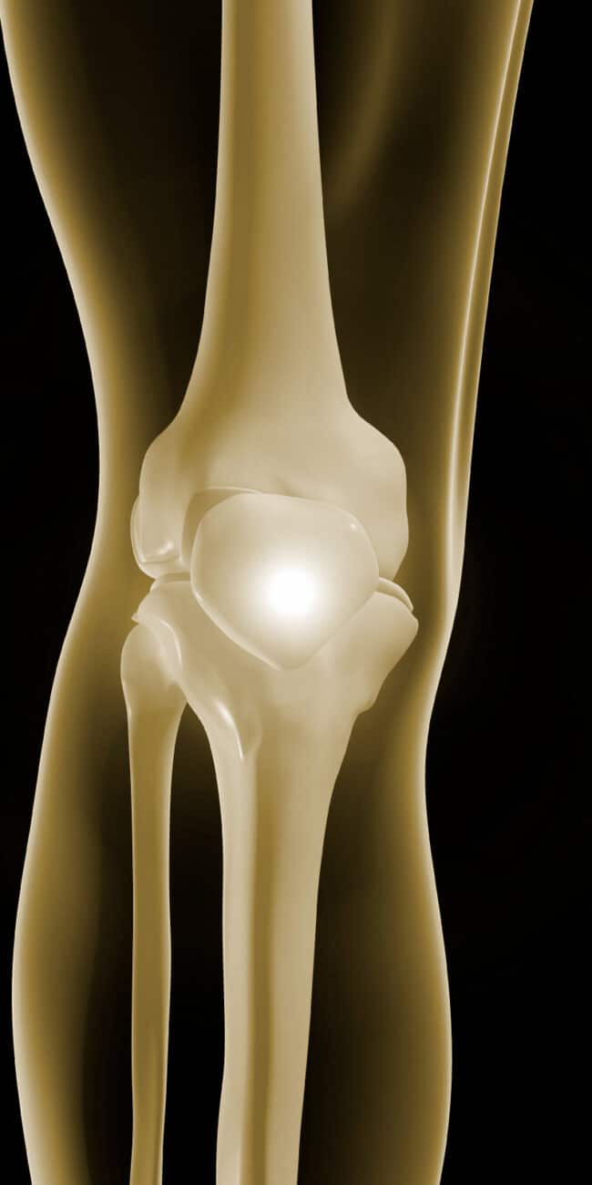 Outpatient Hip and Knee Replacement Team