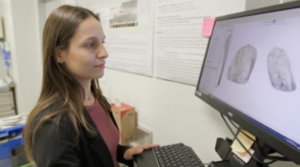 RUSH Implant Research: Advancing Joint Replacement Technology